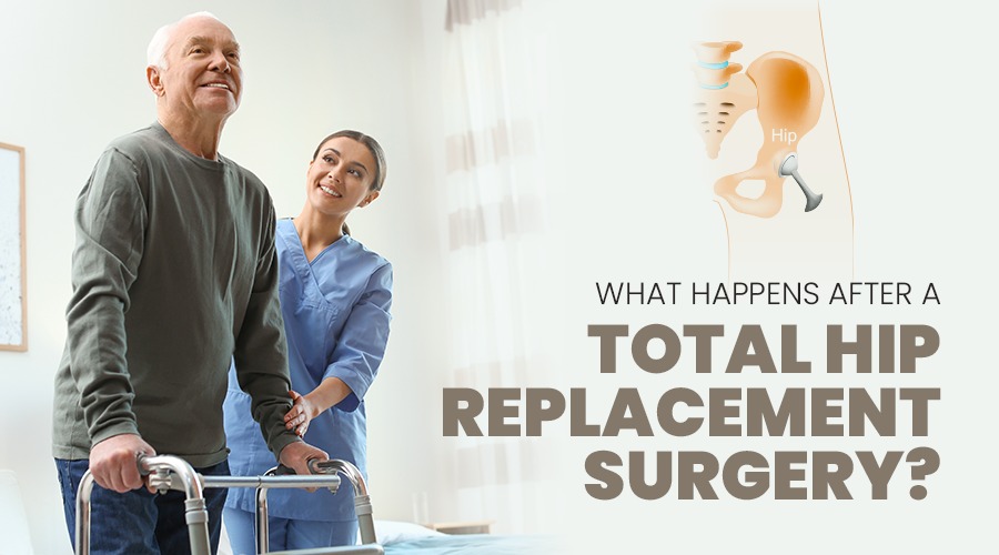 What Happens After A Total Hip Replacement Surgery?